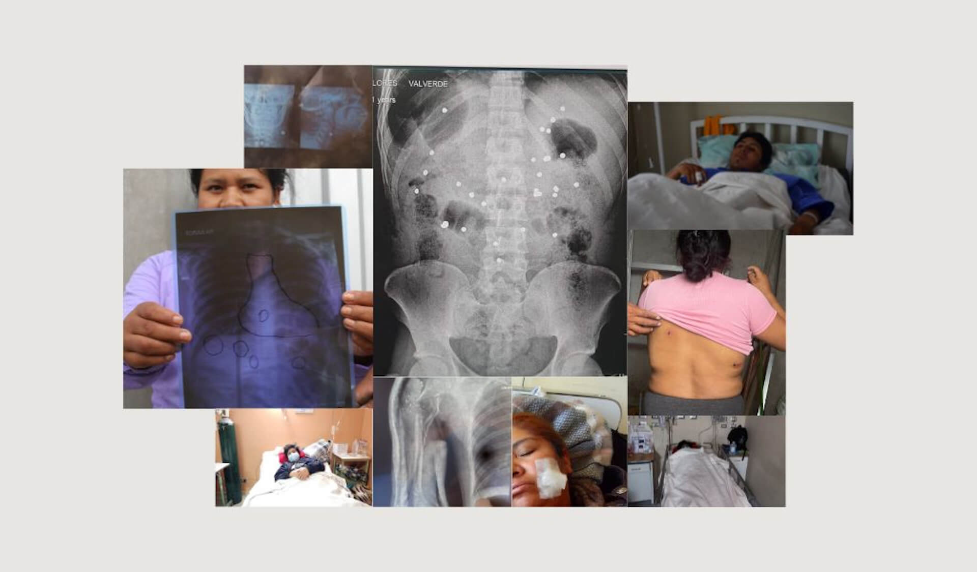 INCERTIDUMBRE. Hasta el 20 de enero, 76 heridos durante las protestas seguían hospitalizados, algunos en estado grave.  