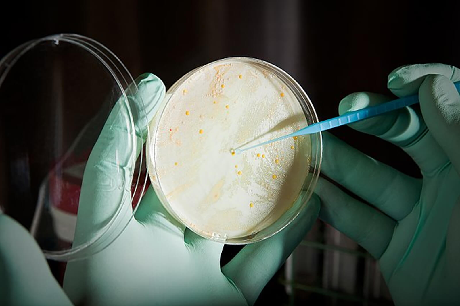 MICROORGANISMOS. Bacterias intrahospitalarias se pueden multiplicar en ambientes que no respetan protocolos.
