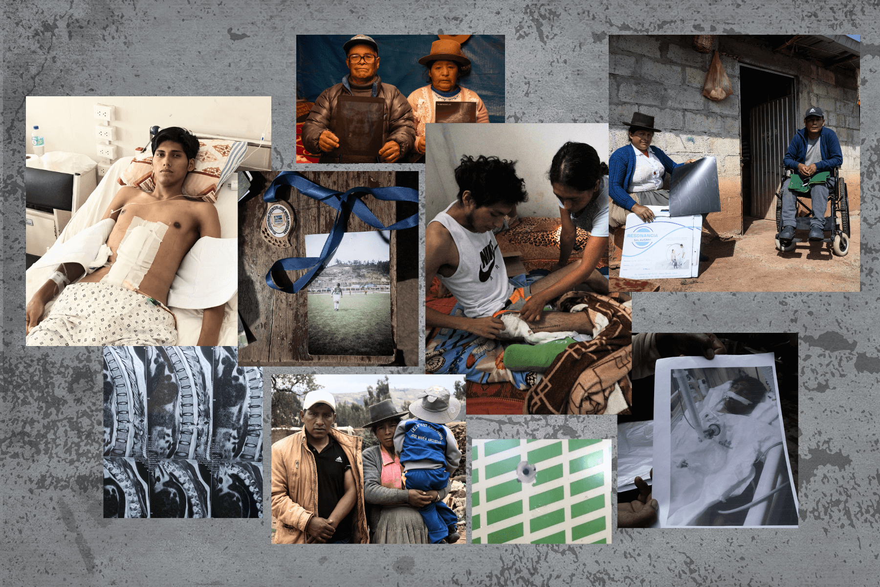 VÍCTIMAS. Personas agredidas durante las manifestaciones contra el gobierno viven con secuelas. 