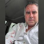 ATENTADO. Precandidato Rafael Belaunde fue atacado a balazos mientras se desplazaba en su vehículo.