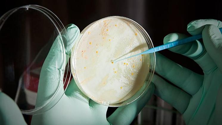 MICROORGANISMOS. Bacterias intrahospitalarias se pueden multiplicar en ambientes que no respetan protocolos.