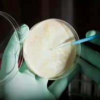 MICROORGANISMOS. Bacterias intrahospitalarias se pueden multiplicar en ambientes que no respetan protocolos.